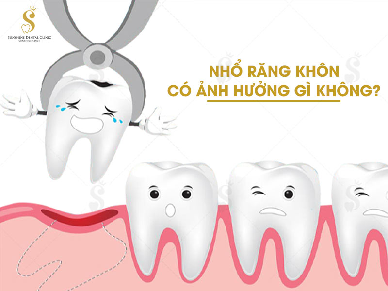 Nhổ răng khôn có ảnh hưởng gì không còn phụ thuộc vào tình trạng răng cũng như cơ sở nha khoa mà bạn lựa chọn