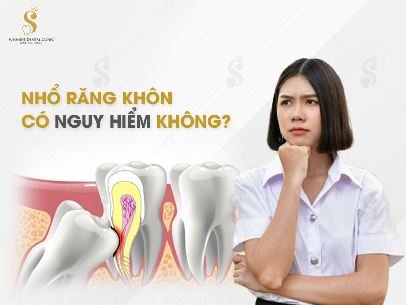 Nhiều người lo lắng nhổ răng khôn có nguy hiểm không?