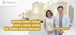 review-nho-rang-khon-va-trong-rang-implant