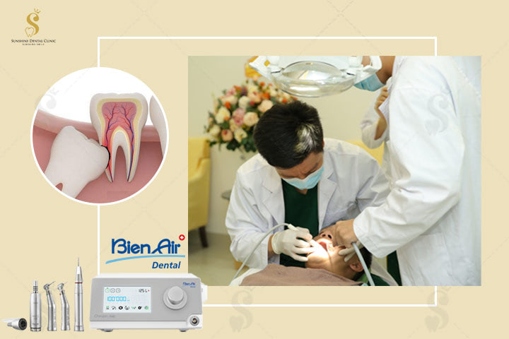 Công nghệ Bien Air giúp nhổ răng khôn an toàn và chấm dứt cơn đau nhanh chóng