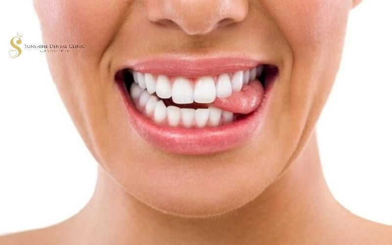 Dùng lưỡi cải thiện răng hô nhẹ